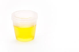 Urine fermentée sur 1 semaine