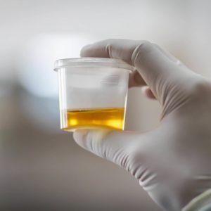 Urine d'un (1) jour